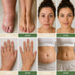 Lymphatic Drainage Formula